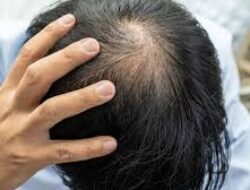 Tips Kesehatan Harian Agar Rambut Tetap Sehat Kuat Tidak Mudah Rontok